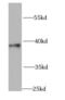 Guanine nucleotide-binding protein G(o) subunit alpha antibody, FNab03534, FineTest, Western Blot image 