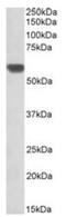 PGI antibody, AP10042PU-N, Origene, Western Blot image 