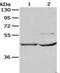 Neutral Cholesterol Ester Hydrolase 1 antibody, MBS2517098, MyBioSource, Western Blot image 