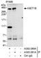 Histone-lysine N-methyltransferase SETD1B antibody, A302-280A, Bethyl Labs, Immunoprecipitation image 