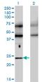 Transcription Factor EC antibody, MA5-21347, Invitrogen Antibodies, Western Blot image 