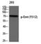 IL2 Inducible T Cell Kinase antibody, PA5-40292, Invitrogen Antibodies, Western Blot image 