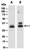 Histamine N-Methyltransferase antibody, orb66791, Biorbyt, Western Blot image 
