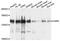 Valyl-TRNA Synthetase antibody, PA5-76475, Invitrogen Antibodies, Western Blot image 