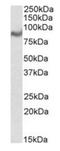 Growth Differentiation Factor 15 antibody, orb19578, Biorbyt, Western Blot image 
