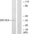 Olfactory Receptor Family 13 Subfamily C Member 4 antibody, A30861, Boster Biological Technology, Western Blot image 