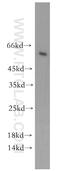 Cytochrome P450 Family 4 Subfamily Z Member 1 antibody, 20142-1-AP, Proteintech Group, Western Blot image 