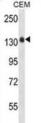 Collagen Type IV Alpha 5 Chain antibody, abx030218, Abbexa, Western Blot image 