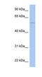 Tripartite Motif Containing 58 antibody, NBP1-79706, Novus Biologicals, Western Blot image 