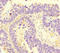 Sterile Alpha Motif Domain Containing 7 antibody, orb34105, Biorbyt, Immunohistochemistry paraffin image 
