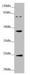 G Protein Subunit Alpha 15 antibody, LS-C675816, Lifespan Biosciences, Western Blot image 