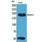 Rho Associated Coiled-Coil Containing Protein Kinase 2 antibody, LS-C386959, Lifespan Biosciences, Western Blot image 