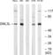 G Protein Nucleolar 3 Like antibody, LS-C120034, Lifespan Biosciences, Western Blot image 