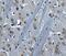 Bruton Tyrosine Kinase antibody, A00245, Boster Biological Technology, Immunohistochemistry paraffin image 