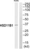 Hydroxysteroid 11-Beta Dehydrogenase 1 antibody, abx014399, Abbexa, Western Blot image 