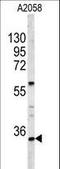 HOXA9 antibody, LS-B10715, Lifespan Biosciences, Western Blot image 