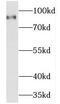 Myristoylated alanine-rich C-kinase substrate antibody, FNab05007, FineTest, Western Blot image 