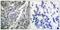 Synaptotagmin 1 antibody, PA5-37751, Invitrogen Antibodies, Immunohistochemistry paraffin image 