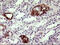 F11 Receptor antibody, M02068-2, Boster Biological Technology, Immunohistochemistry paraffin image 