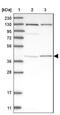 Intraflagellar Transport 57 antibody, NBP1-84787, Novus Biologicals, Western Blot image 