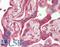 NFKB Inhibitor Alpha antibody, LS-B12430, Lifespan Biosciences, Immunohistochemistry paraffin image 