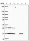 RAS Like Proto-Oncogene B antibody, NBP2-46872, Novus Biologicals, Western Blot image 