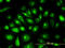 Keratin 81 antibody, LS-B4365, Lifespan Biosciences, Immunofluorescence image 