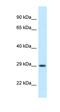 Oligodendrocyte Transcription Factor 1 antibody, orb330458, Biorbyt, Western Blot image 