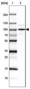SEC63 Homolog, Protein Translocation Regulator antibody, NBP2-30405, Novus Biologicals, Western Blot image 