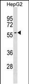 Sphingomyelin phosphodiesterase 3 antibody, PA5-49140, Invitrogen Antibodies, Western Blot image 