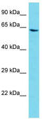 ArfGAP With GTPase Domain, Ankyrin Repeat And PH Domain 11 antibody, TA335408, Origene, Western Blot image 