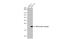 HRas Proto-Oncogene, GTPase antibody, GTX636434, GeneTex, Western Blot image 