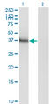 Homeobox A11 antibody, LS-C133256, Lifespan Biosciences, Western Blot image 