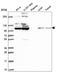 Fibroblast Growth Factor Receptor 2 antibody, HPA056562, Atlas Antibodies, Western Blot image 