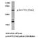 Protein Tyrosine Phosphatase Non-Receptor Type 11 antibody, LS-C177949, Lifespan Biosciences, Western Blot image 