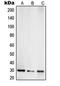 Toll Interacting Protein antibody, LS-C353474, Lifespan Biosciences, Western Blot image 