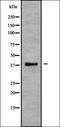 Interleukin 27 Receptor Subunit Alpha antibody, orb336345, Biorbyt, Western Blot image 