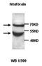 Nudix Hydrolase 6 antibody, orb76967, Biorbyt, Western Blot image 