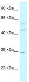 LSM14A MRNA Processing Body Assembly Factor antibody, TA333807, Origene, Western Blot image 