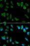 Interleukin 1 Receptor Antagonist antibody, LS-B14528, Lifespan Biosciences, Immunofluorescence image 