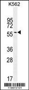 Eukaryotic Translation Initiation Factor 2B Subunit Delta antibody, MBS9201859, MyBioSource, Western Blot image 