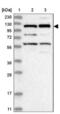 Kinesin Family Member 5C antibody, NBP1-87429, Novus Biologicals, Western Blot image 