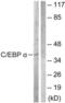 CCAAT Enhancer Binding Protein Alpha antibody, LS-C117832, Lifespan Biosciences, Western Blot image 