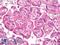 Fms Related Tyrosine Kinase 1 antibody, LS-B7387, Lifespan Biosciences, Immunohistochemistry paraffin image 