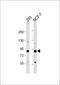 Collagen Type IX Alpha 1 Chain antibody, A04554-2, Boster Biological Technology, Western Blot image 