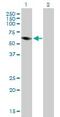 Preferentially Expressed Antigen In Melanoma antibody, ab89097, Abcam, Western Blot image 