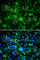 SET And MYND Domain Containing 3 antibody, A7309, ABclonal Technology, Immunofluorescence image 