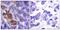 Ribosomal Protein S6 Kinase A5 antibody, PA5-38369, Invitrogen Antibodies, Immunohistochemistry frozen image 