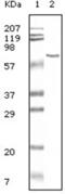 Albumin antibody, abx015700, Abbexa, Enzyme Linked Immunosorbent Assay image 