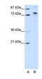 TOX High Mobility Group Box Family Member 4 antibody, orb324782, Biorbyt, Western Blot image 